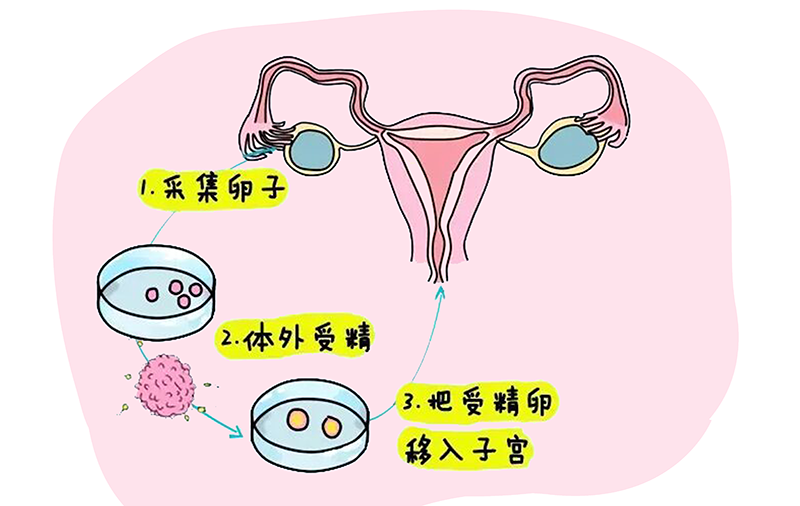 国内哪里洗精做试管,永康精子库护士,“精子库”的女护士